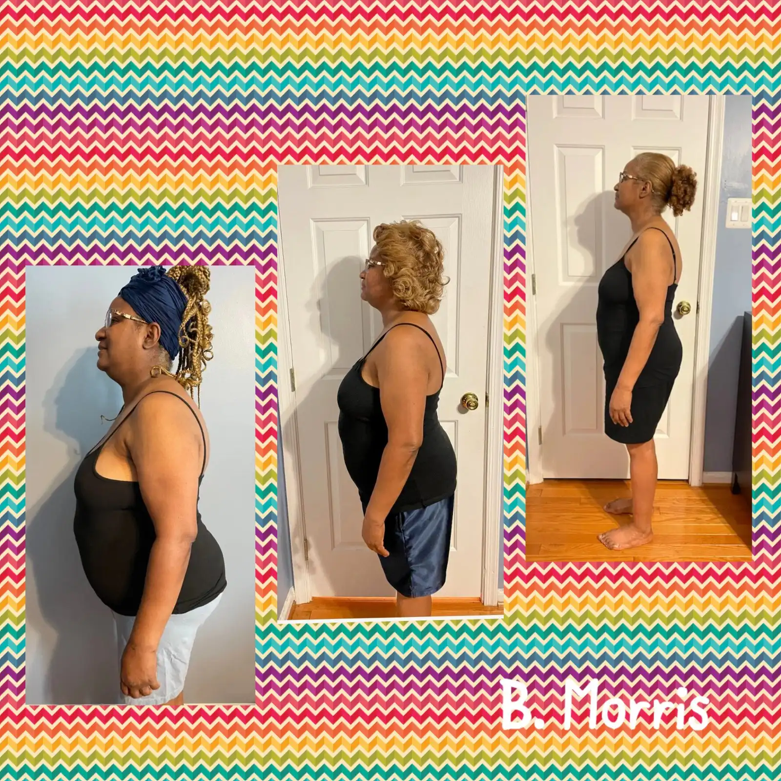 Weight Loss Before and After4 at The Wellness NPs in Annandale, VA