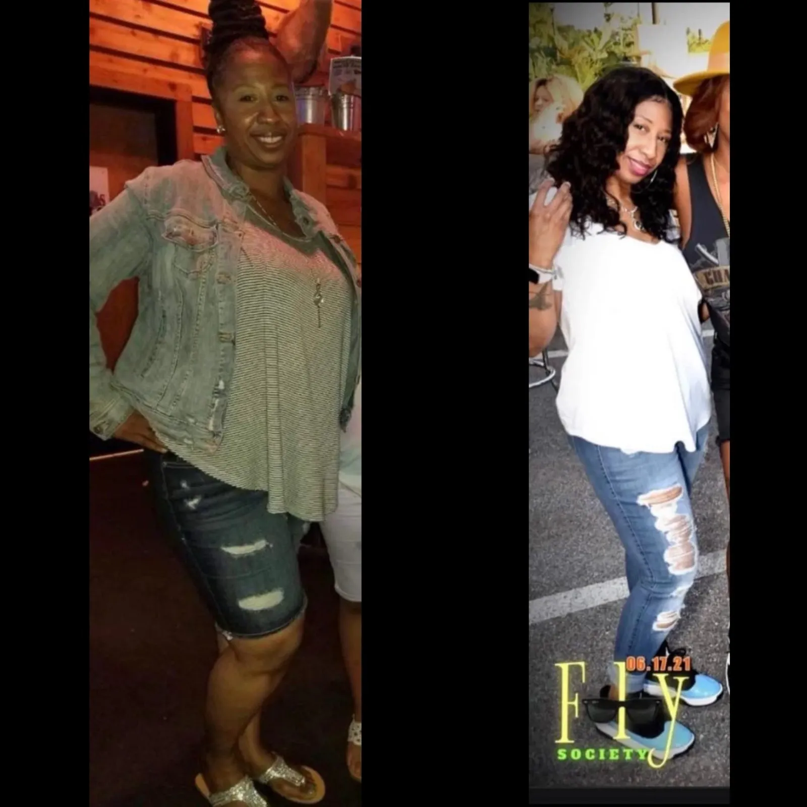 Weight Loss Before and After3 at The Wellness NPs in Annandale, VA