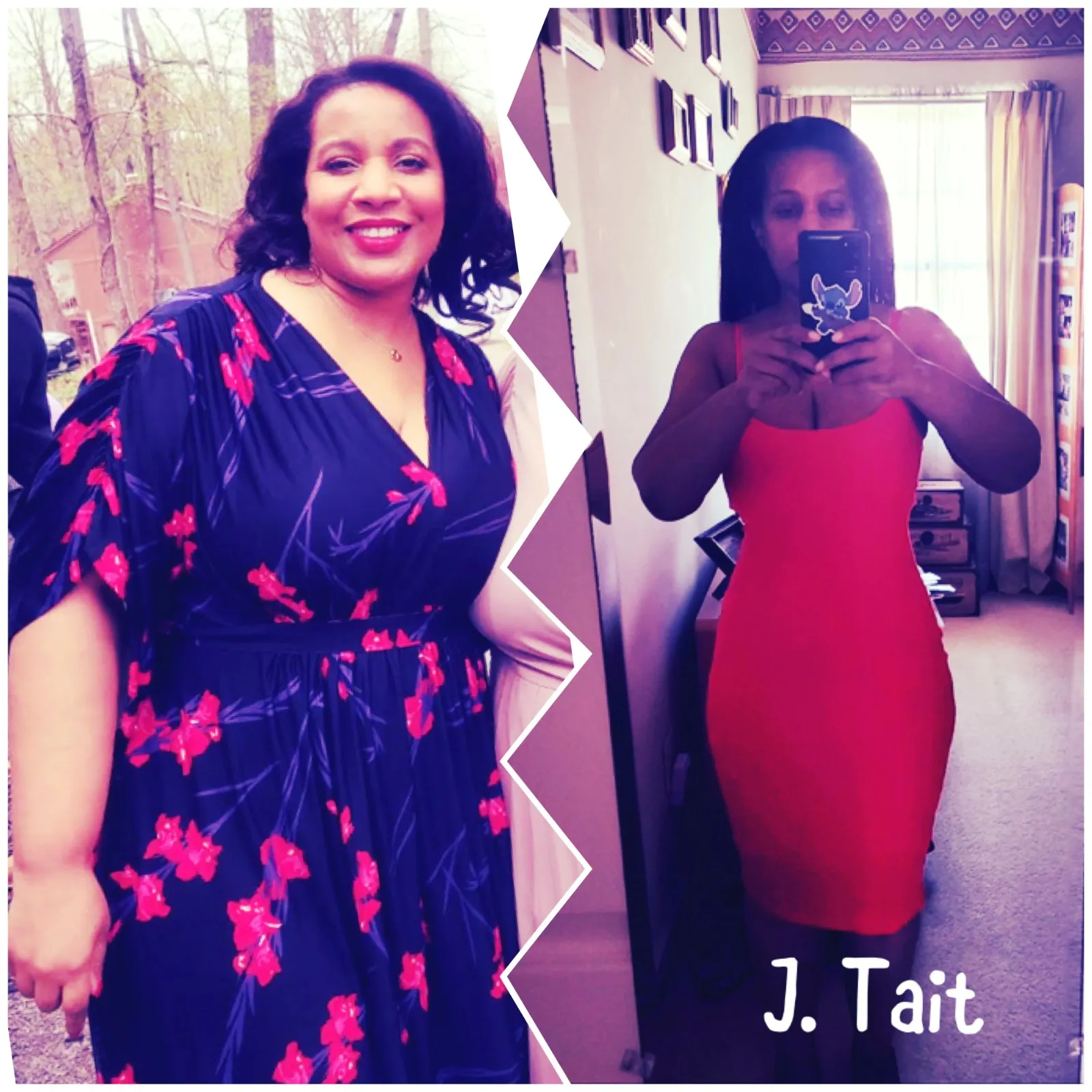 Weight Loss Before and After at The Wellness NPs in Annandale, VA